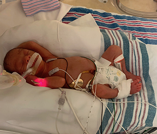 NICU baby Jamie Coleman