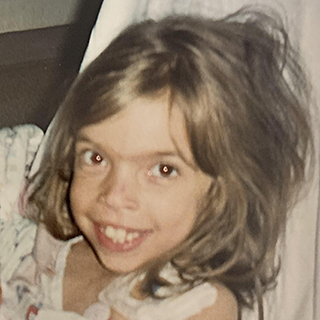 Childhood photo of Kali, receipient of a kidney from a living donor.